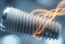 A close-up, photorealistic image of a titanium dental implant, with glowing abstract lines symbolizing the bone fusion and healing process of osseointegration.