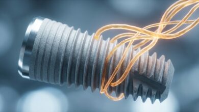 A close-up, photorealistic image of a titanium dental implant, with glowing abstract lines symbolizing the bone fusion and healing process of osseointegration.