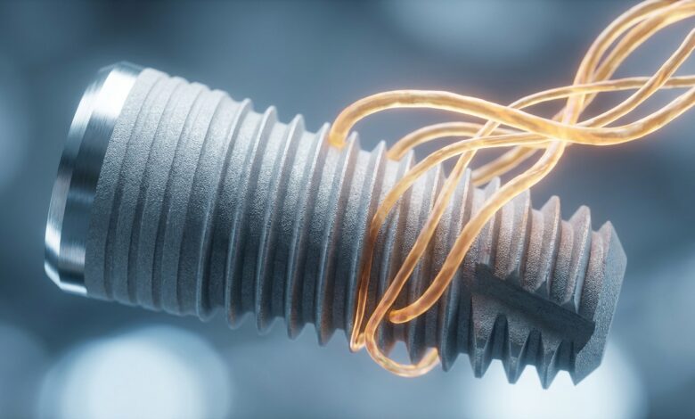 A close-up, photorealistic image of a titanium dental implant, with glowing abstract lines symbolizing the bone fusion and healing process of osseointegration.