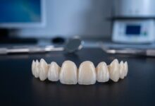 A photorealistic close-up of several perfectly crafted porcelain dental veneers resting on a clean, dark surface in a modern, out-of-focus dental laboratory setting. The cinematic lighting emphasizes their realistic translucency and shape.