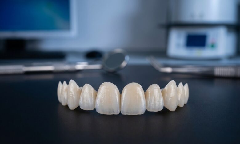 A photorealistic close-up of several perfectly crafted porcelain dental veneers resting on a clean, dark surface in a modern, out-of-focus dental laboratory setting. The cinematic lighting emphasizes their realistic translucency and shape.