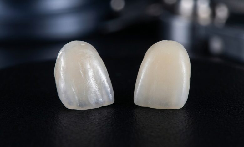 A close-up, photorealistic image showing two different types of dental veneers side-by-side for comparison. The porcelain veneer on the left is translucent and mimics natural enamel, while the composite veneer on the right is more opaque.