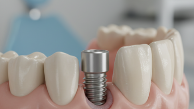 Close-up, highly detailed image of a dental implant partially embedded in realistic gum and bone tissue, showing subtle signs of inflammation and minor gum recession around the implant collar. The titanium screw is visible, implying a potential issue with osseointegration or peri-implantitis. The background is a clean, blurred dental environment.