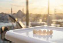 A photorealistic close-up of perfectly crafted dental veneers on a clean surface. In the background, the Istanbul, Turkey skyline is beautifully blurred out of focus through a window during a warm sunset, representing dental tourism.