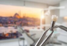 A close-up, photorealistic image of a high-tech dental implant and crown inside a modern clinic, with the beautifully blurred skyline of Istanbul, Turkey visible through a window in the background.