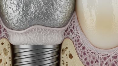 A close-up, photorealistic, microscopic view of a titanium dental implant surface partially embedded in jawbone, showing a distinct layer of soft fibrous tissue forming between the implant and the bone, signifying a failure of osseointegration. The surrounding bone shows some cellular detail.