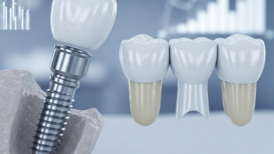 A close-up, highly detailed photorealistic image comparing a single dental implant with a titanium post, abutment, and porcelain crown, placed beside a three-unit dental bridge consisting of two crowns and a central pontic. The setting is clean, clinical, and modern, with a softly blurred background hinting at data or value comparison. No text is visible.