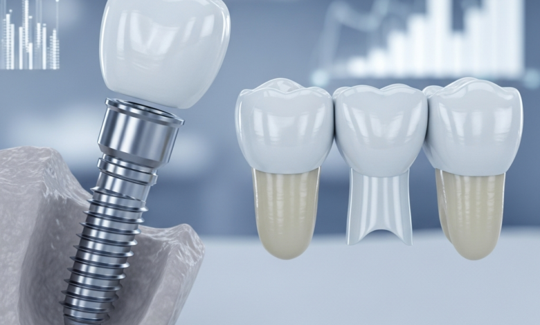 A close-up, highly detailed photorealistic image comparing a single dental implant with a titanium post, abutment, and porcelain crown, placed beside a three-unit dental bridge consisting of two crowns and a central pontic. The setting is clean, clinical, and modern, with a softly blurred background hinting at data or value comparison. No text is visible.