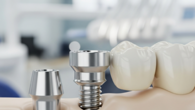 Close-up, photorealistic view of a dental implant with a titanium post, abutment, and a natural-looking ceramic crown, seamlessly blending with healthy teeth in a subtly blurred modern dental clinic background. No text is visible.