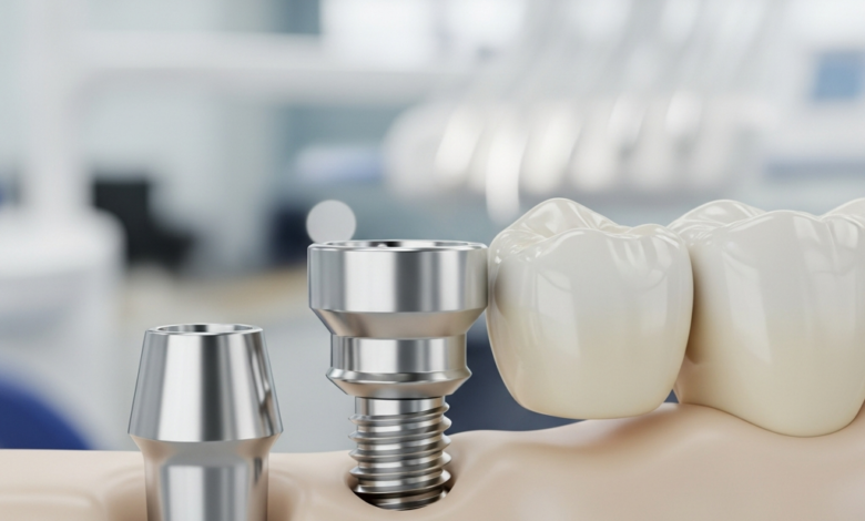 Close-up, photorealistic view of a dental implant with a titanium post, abutment, and a natural-looking ceramic crown, seamlessly blending with healthy teeth in a subtly blurred modern dental clinic background. No text is visible.