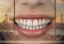 A close-up of a person's mouth displaying a bright, healthy, and perfectly aligned smile, emphasizing the aesthetic results of cosmetic dental bonding. The background is a soft blur of a modern dental clinic interior and a distant Turkish cityscape, subtly hinting at the location.
