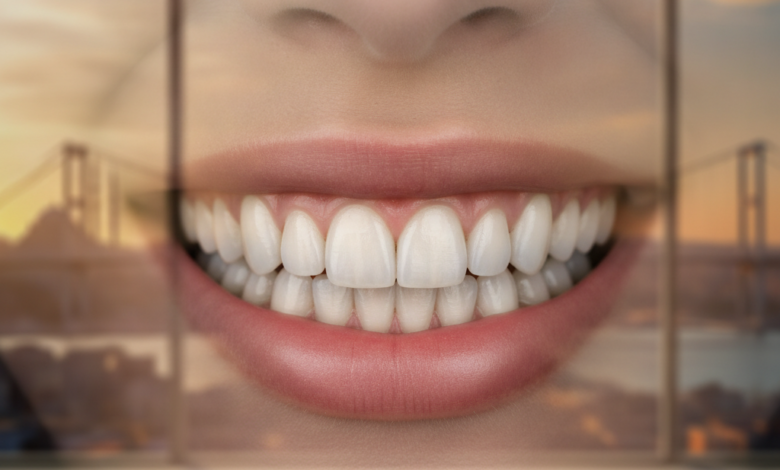 A close-up of a person's mouth displaying a bright, healthy, and perfectly aligned smile, emphasizing the aesthetic results of cosmetic dental bonding. The background is a soft blur of a modern dental clinic interior and a distant Turkish cityscape, subtly hinting at the location.