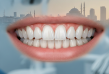 A close-up view of a healthy, pink, and perfectly contoured gum line framing bright white teeth, indicating a beautiful, symmetrical smile. The background is an indistinct, soft blur of a modern dental clinic interior, with a very faint, blurred silhouette of a city skyline in the far distance.