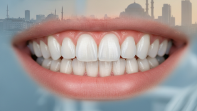 A close-up view of a healthy, pink, and perfectly contoured gum line framing bright white teeth, indicating a beautiful, symmetrical smile. The background is an indistinct, soft blur of a modern dental clinic interior, with a very faint, blurred silhouette of a city skyline in the far distance.