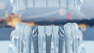 Close-up of an ultra-detailed anatomical model demonstrating the All-on-4 dental implant technique, with four metallic implants precisely placed into a jawbone. The background features a soft-focused, blurred architectural silhouette suggestive of Istanbul, Turkey.