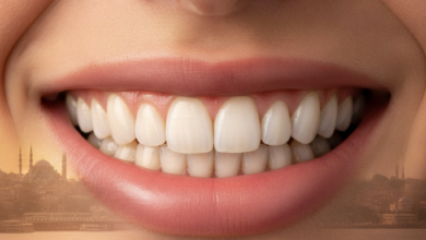 Close-up of a bright, healthy, and natural-looking smile with perfectly aligned teeth, suggesting the successful outcome of cosmetic dental bonding. The background is a blurred, warm panorama of a Turkish cityscape, specifically hinting at Istanbul with its iconic landmarks and water.