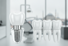 A photorealistic image with a shallow depth of field, featuring a conceptual dental implant on the left and a conceptual dental bridge on the right. Both are gleaming white ceramic, highly detailed, and appear technologically advanced. The background is a blurred modern dental clinic, and through a window, an even more blurred cityscape, indicative of Istanbul, Turkey, is visible. No text is present.