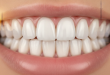 A close-up, photorealistic image of a perfect, bright white smile, representing successful dental crown treatment. The background is a heavily blurred, warm-toned cityscape of Istanbul, Turkey, with architectural hints, emphasizing dental tourism.