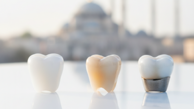 Three different types of dental crowns (zirconia, E-max, and porcelain-fused-to-metal) displayed on a sterile surface in a modern dental clinic, with a blurred background showing an iconic Turkish city skyline.