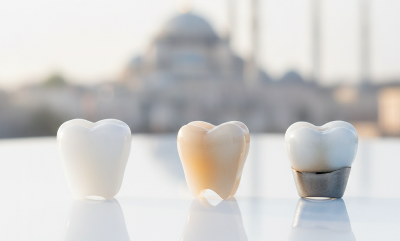 Three different types of dental crowns (zirconia, E-max, and porcelain-fused-to-metal) displayed on a sterile surface in a modern dental clinic, with a blurred background showing an iconic Turkish city skyline.