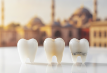 Close-up of multiple gleaming dental crowns (porcelain, zirconia, and porcelain-fused-to-metal) on a clean white surface, with a blurred background subtly featuring warm-toned Turkish architectural elements.