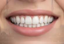 Close-up of a radiant, perfect smile with bright, natural-looking teeth, implying successful dental crown treatment. The background is a soft blur of a modern dental clinic interior and an indistinct Istanbul city skyline through a window.