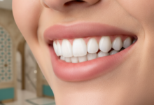 Close-up of a perfect, bright white smile with healthy teeth, suggesting the successful application of dental crowns, set against a softly blurred background of a sophisticated, modern dental clinic in Turkey.
