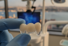 A close-up, photorealistic image of a perfectly crafted, translucent dental crown, held gently by gloved hands. The background shows a modern, sterile dental clinic with advanced equipment, and beyond, a very subtly blurred Turkish cityscape is visible, symbolizing Turkey as a leading destination for dental tourism. The focus is on the crown's intricate details and professional care.