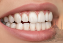 A close-up view of a perfect, bright smile with natural-looking teeth, implying successful dental crown work, set against a softly blurred background of Istanbul, Turkey's cityscape with historical buildings and waterways.